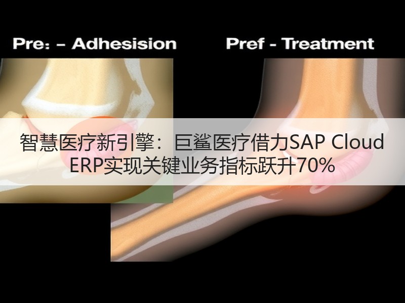 智慧医疗新引擎：巨鲨医疗借力SAP Cloud ERP实现关