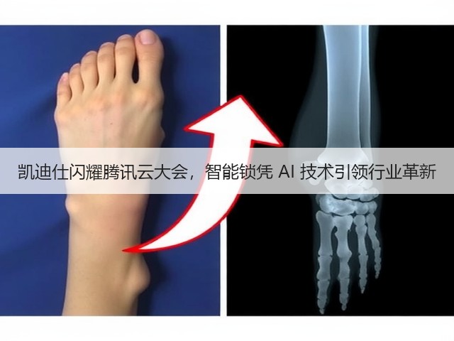 凯迪仕闪耀腾讯云大会,智能锁凭 AI 技术引领行业革新(图1) 凯迪仕闪耀腾讯云大会,智能锁凭 AI 技术引领行业革新(图1)
