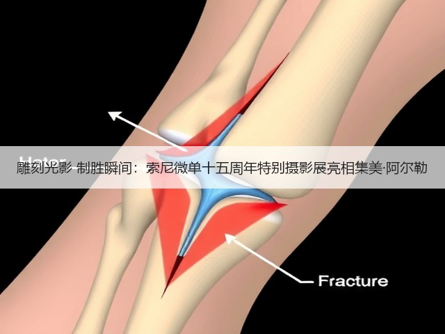 雕刻光影 制胜瞬间:索尼微单十五周年特别摄影展亮相集美·阿尔勒(图2) 雕刻光影 制胜瞬间:索尼微单十五周年特别摄影展亮相集美·阿尔勒(图2)